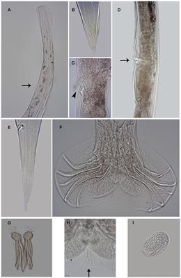 New species of Delicata (Molineidae: Anoplostrongylinae) parasite of Cabassous tatouay (Desmarest, 1804) from the Atlantic Forest, Rio de Janeiro, Brazil